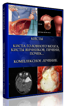 Мини инфопродукт №5. Кисты. Киста головного мозга,_0.png